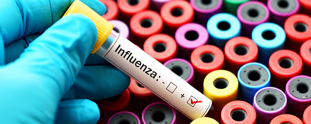 Influenza1